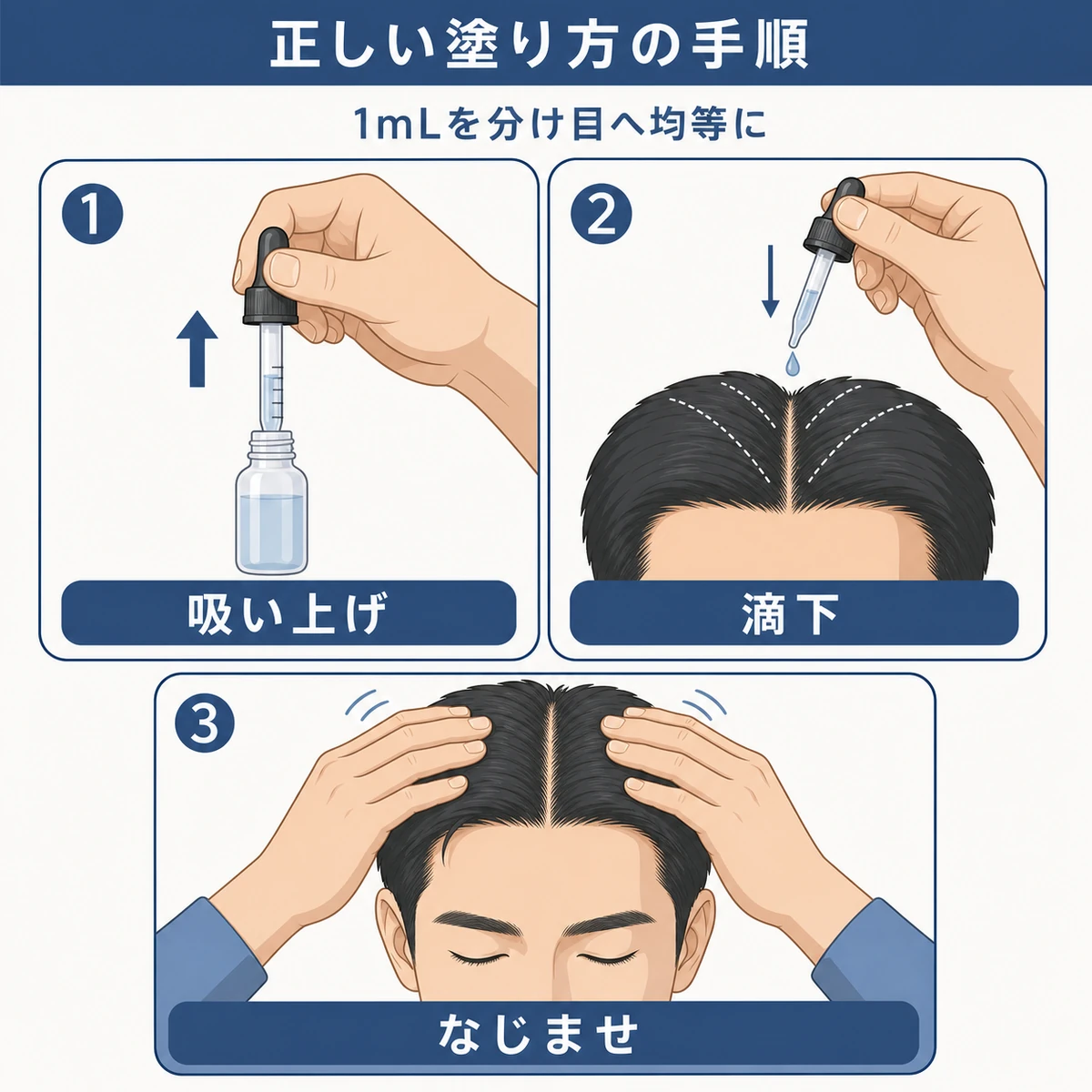 吸い上げから滴下・なじませまでのスポイト式育毛剤の塗り方手順を表した医療イラスト