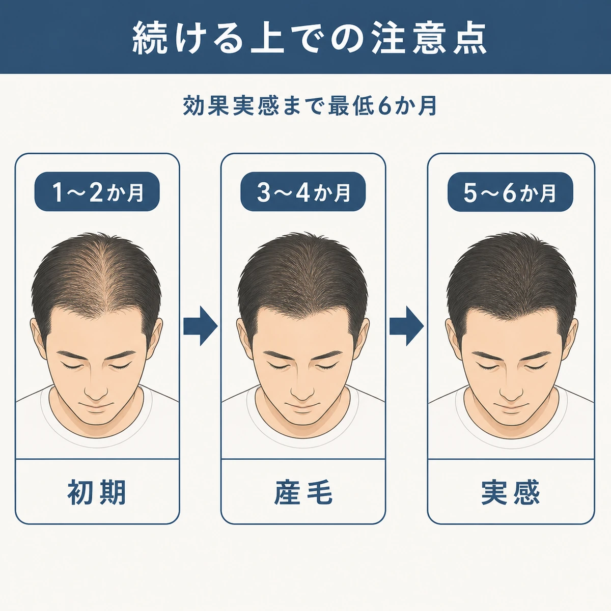 使用開始から半年までの継続と頭皮の変化の目安を表した医療イラスト