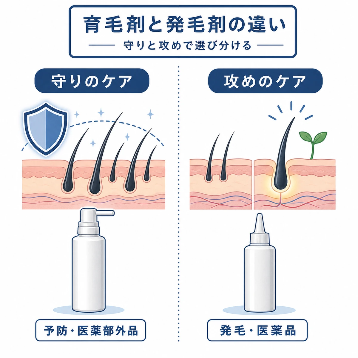 育毛剤と発毛剤の役割の違いを左右で対比した医療イラスト