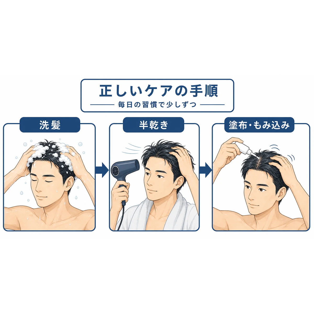 洗髪から塗布までの育毛ケアの手順を左から右の流れで表した医療イラスト