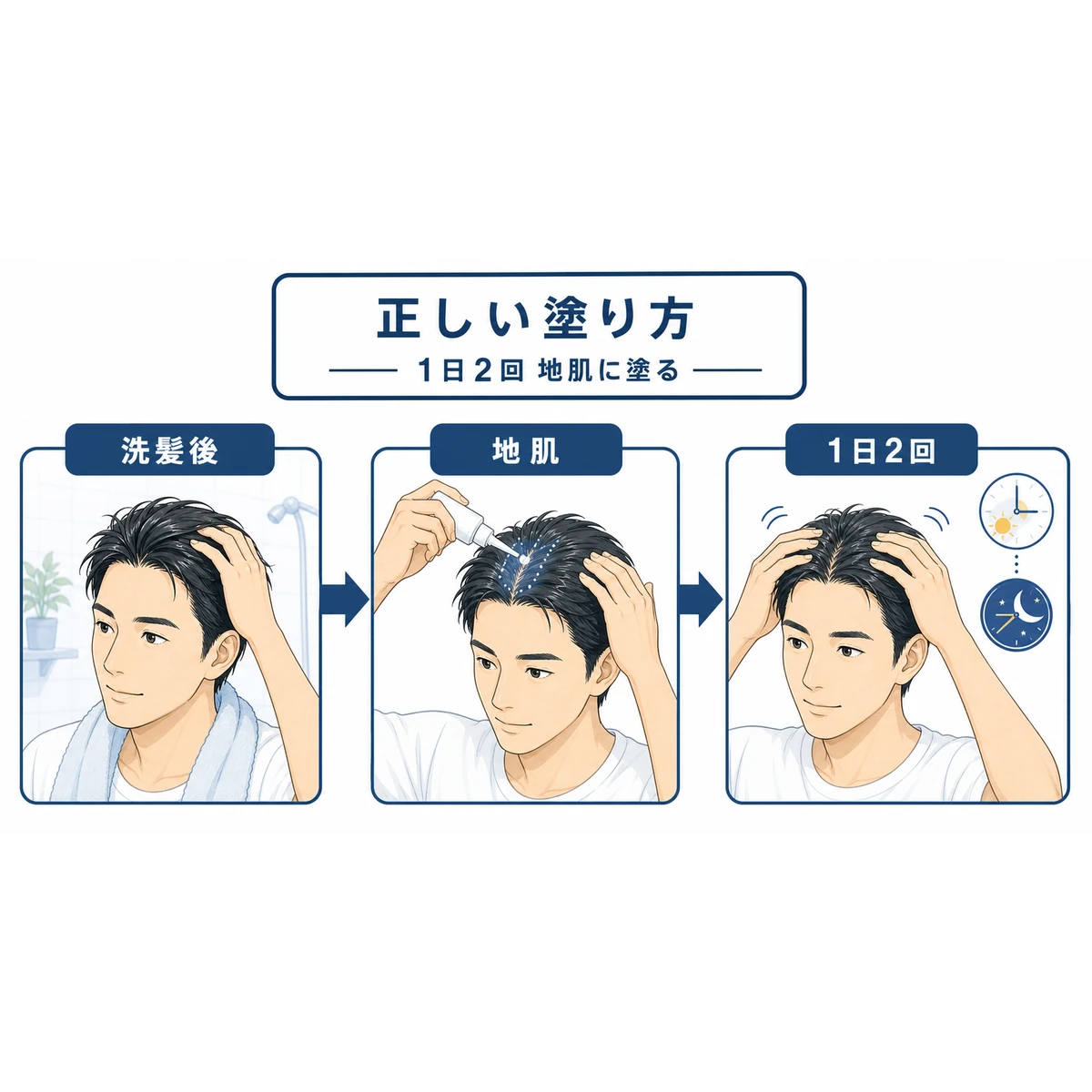 ミノキシジル配合剤の正しい塗り方の流れを描いた解説イラスト