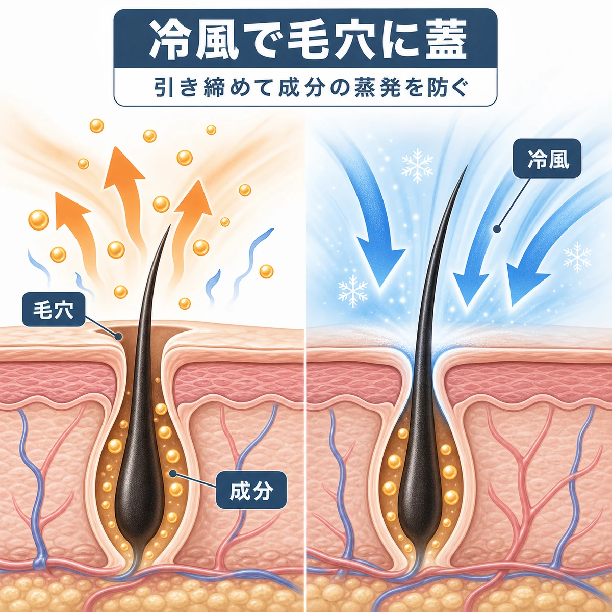 温風で開いた毛穴と冷風で引き締まった毛穴を比べた頭皮断面の医療イラスト