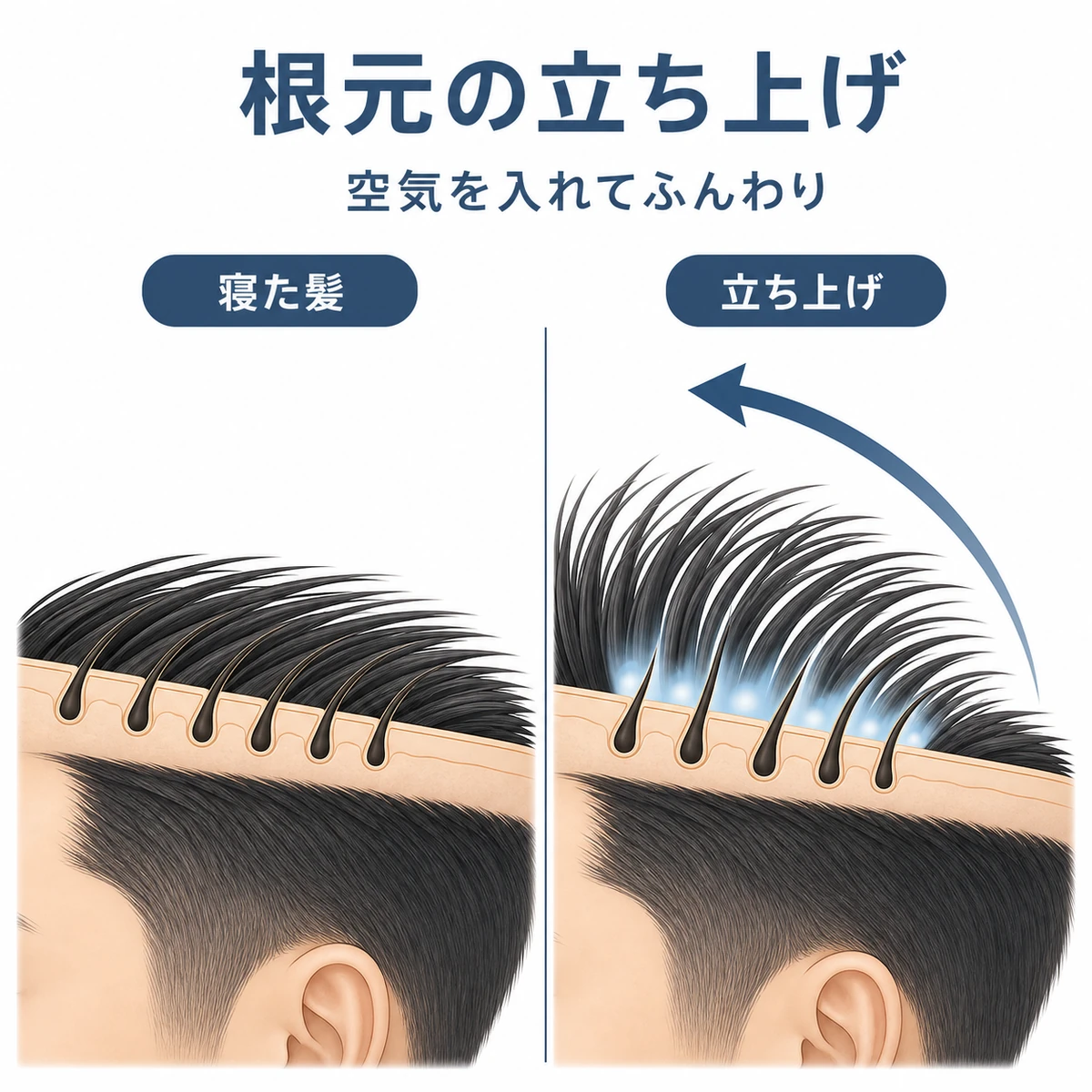 髪の根元を立ち上げて空気を入れふんわりさせる前後の違いを断面で表した医療イラスト