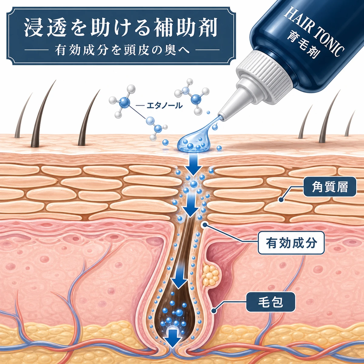 育毛剤のエタノールが有効成分を角質層から毛包へ下向きに届ける浸透補助のしくみを表した頭皮断面の医療イラスト