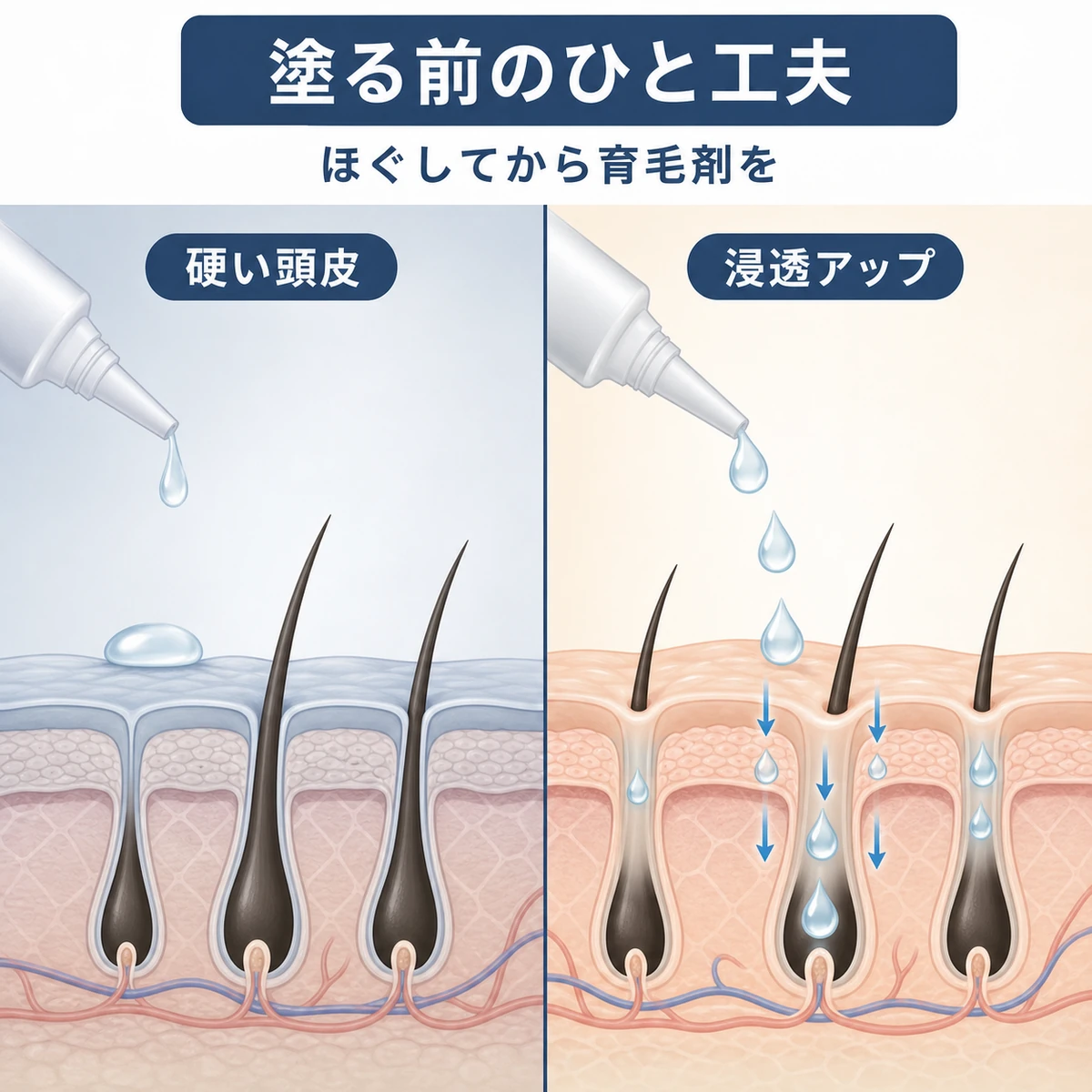 硬い頭皮とほぐした頭皮で育毛剤の浸透の違いを比べた頭皮断面の医療イラスト