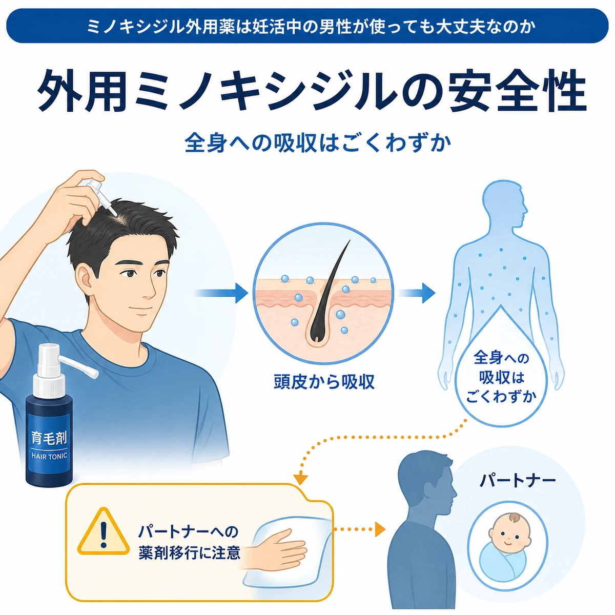 外用ミノキシジルの全身吸収がごくわずかであることとパートナーへの薬剤移行注意を表した医療イラスト