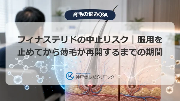 フィナステリドの中止リスク｜服用を止めてから薄毛が再開するまでの期間
