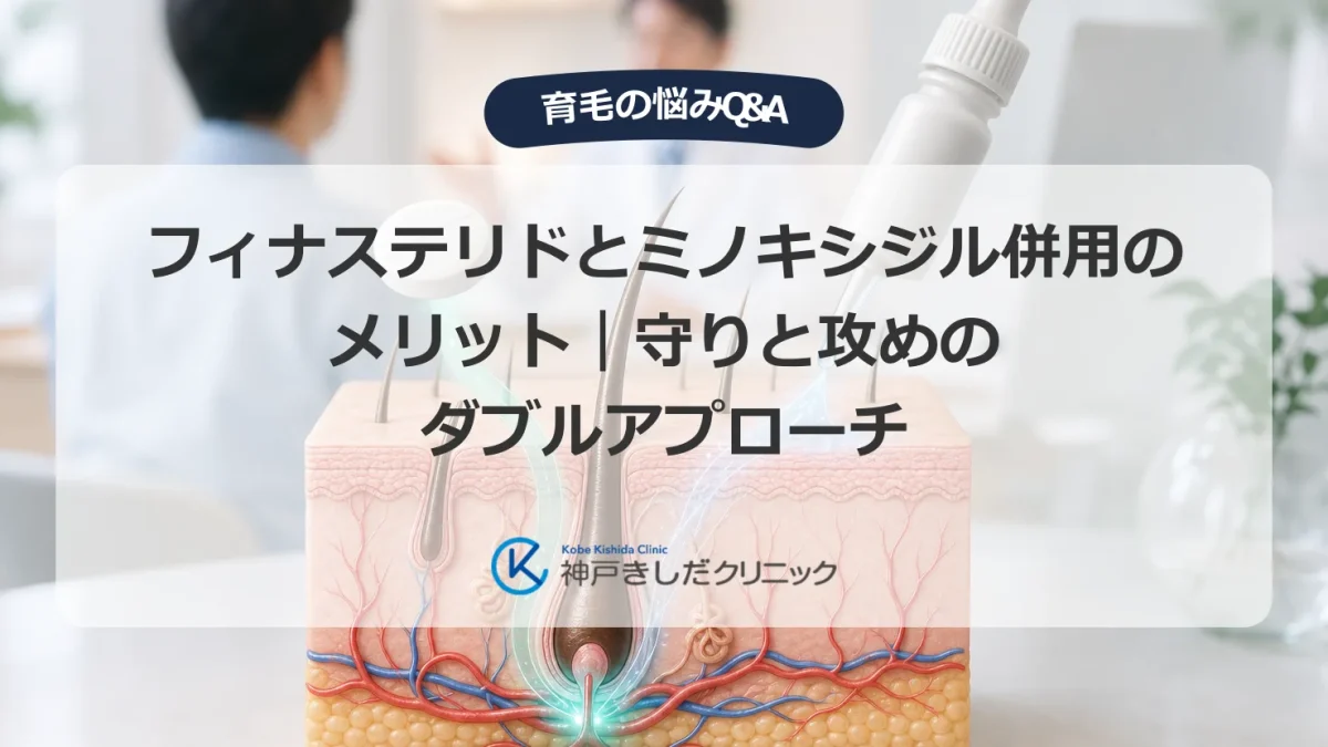 フィナステリドとミノキシジルの併用を検討する男性と毛包の解剖イラスト