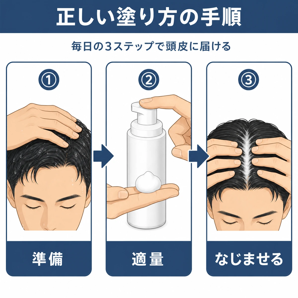 泡タイプ育毛剤を頭皮に塗る手順を左から右に示した医療イラスト