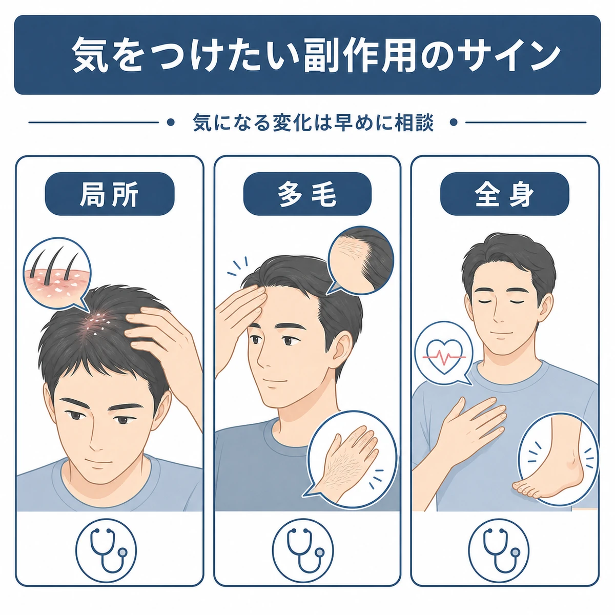 育毛剤で気をつけたい副作用のサインを局所・多毛・全身に分けて示した医療イラスト