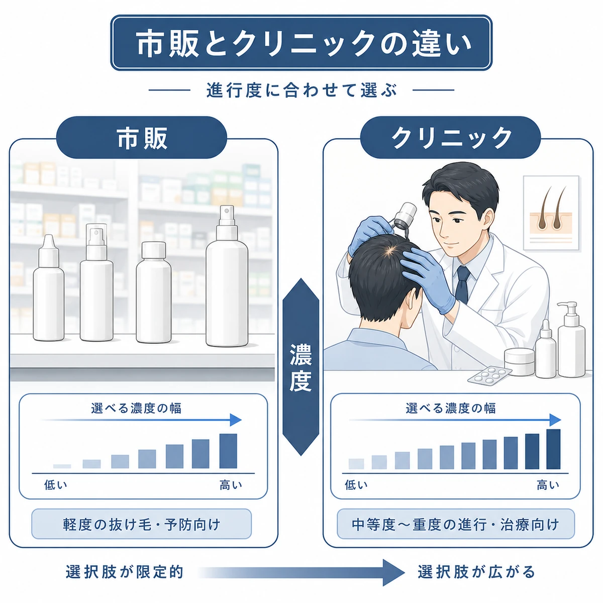 市販の育毛剤とクリニック処方の育毛剤の違いを進行度で見比べた医療イラスト