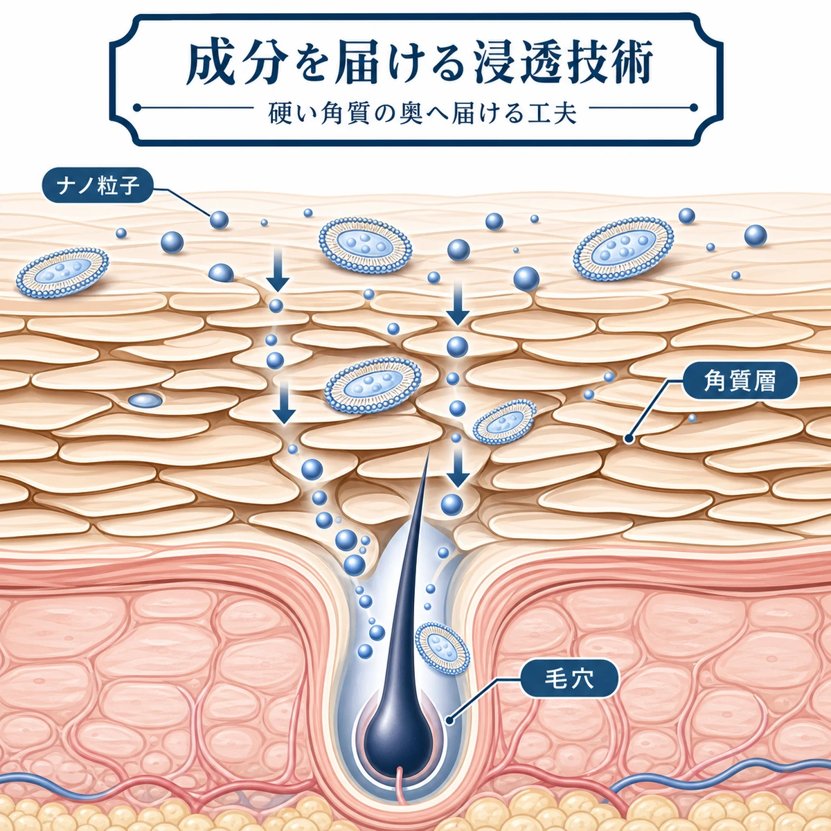ナノ化した成分が硬い角質層を越えて毛穴へ届く様子を表した医療イラスト