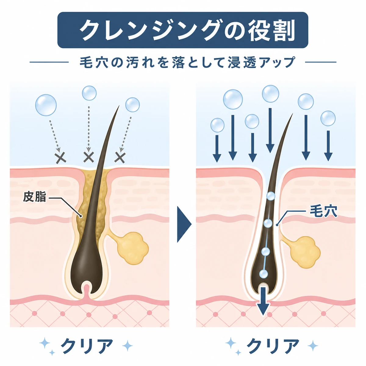 毛穴の汚れを落とす前後で成分の届き方が変わる様子を表した医療イラスト