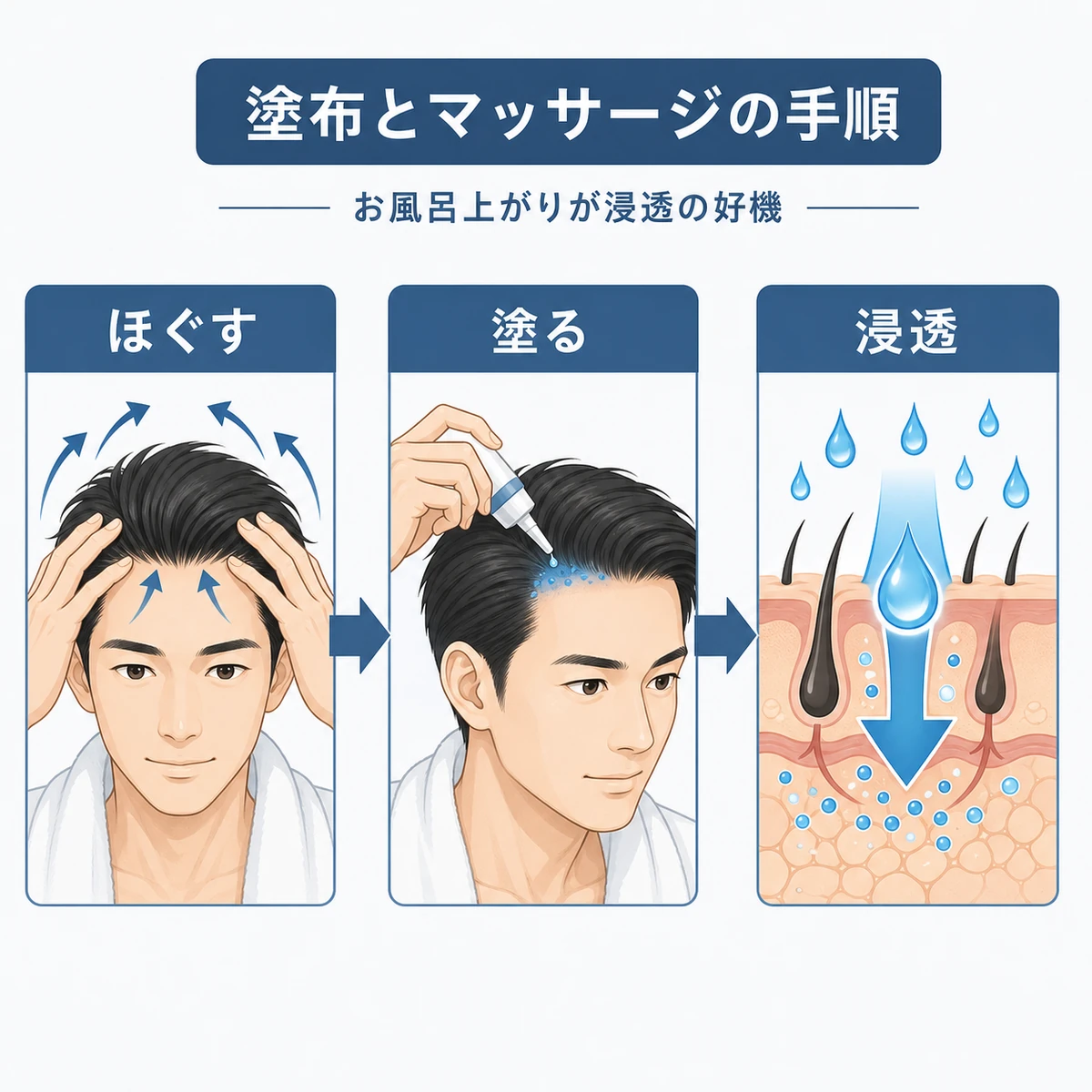 成人男性が生え際をほぐしてから育毛剤を塗る手順を表した医療イラスト