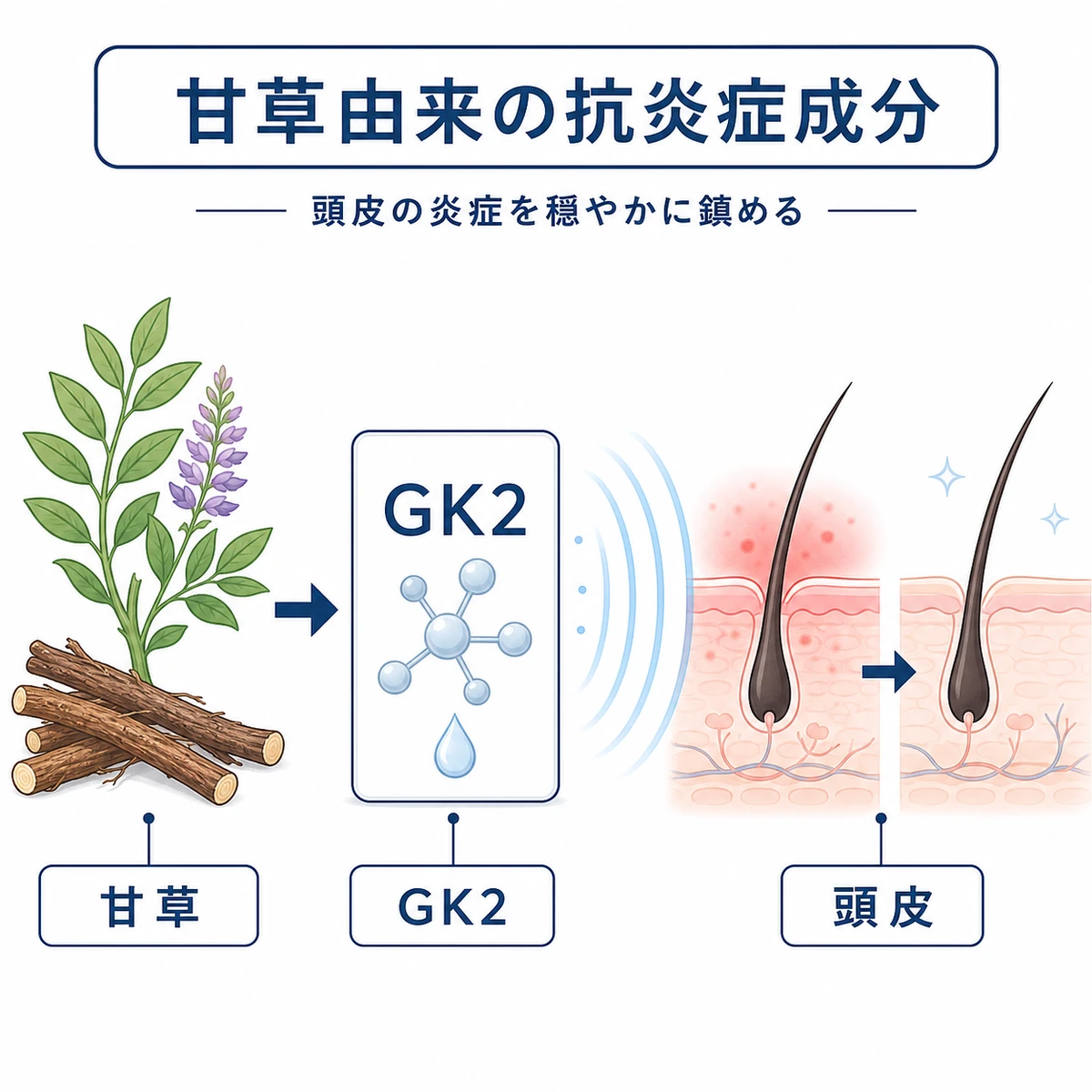 甘草から抽出したGK2が頭皮の炎症を鎮める仕組みを表した医療イラスト