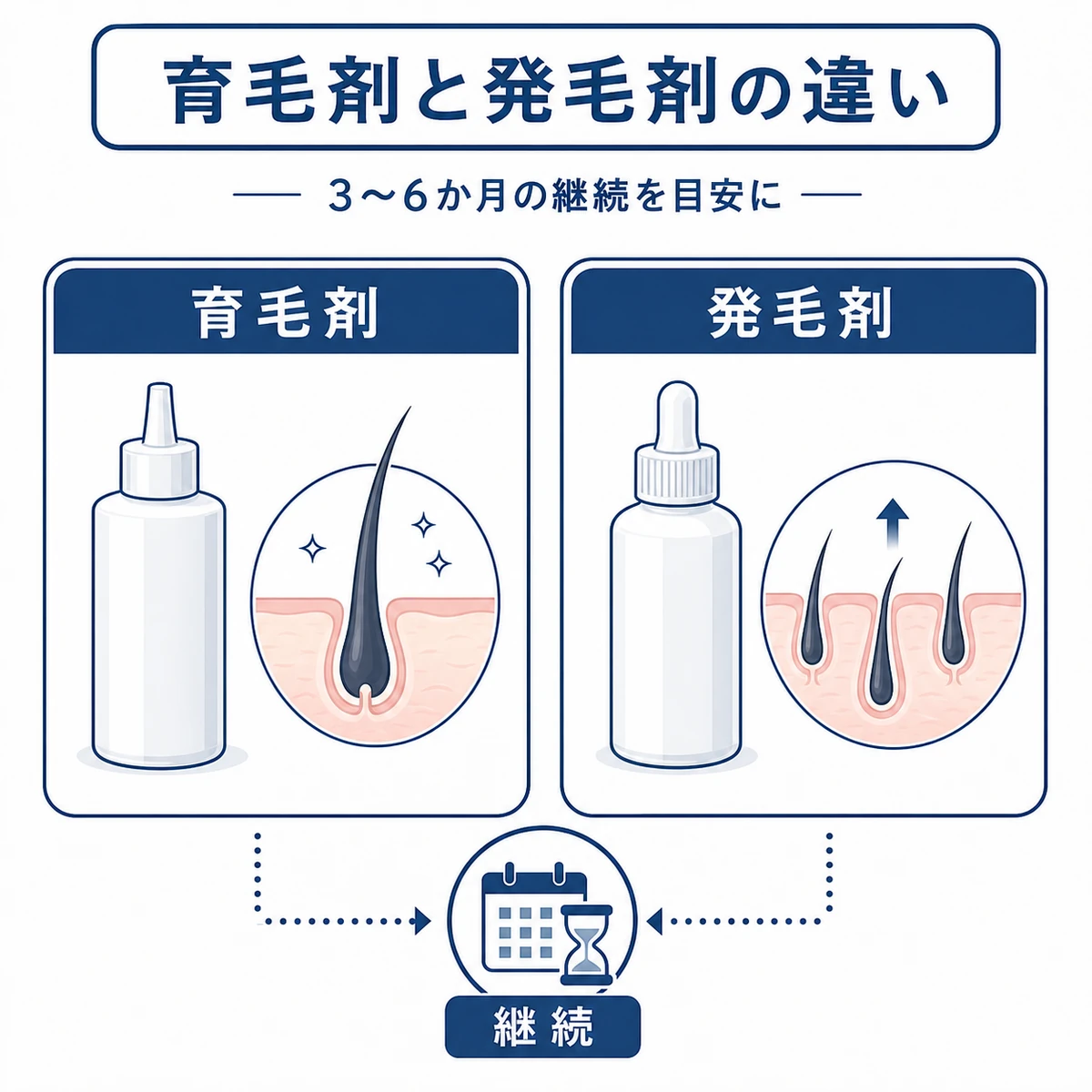 育毛剤と発毛剤の目的の違いと継続期間の目安を対比して示した医療イラスト