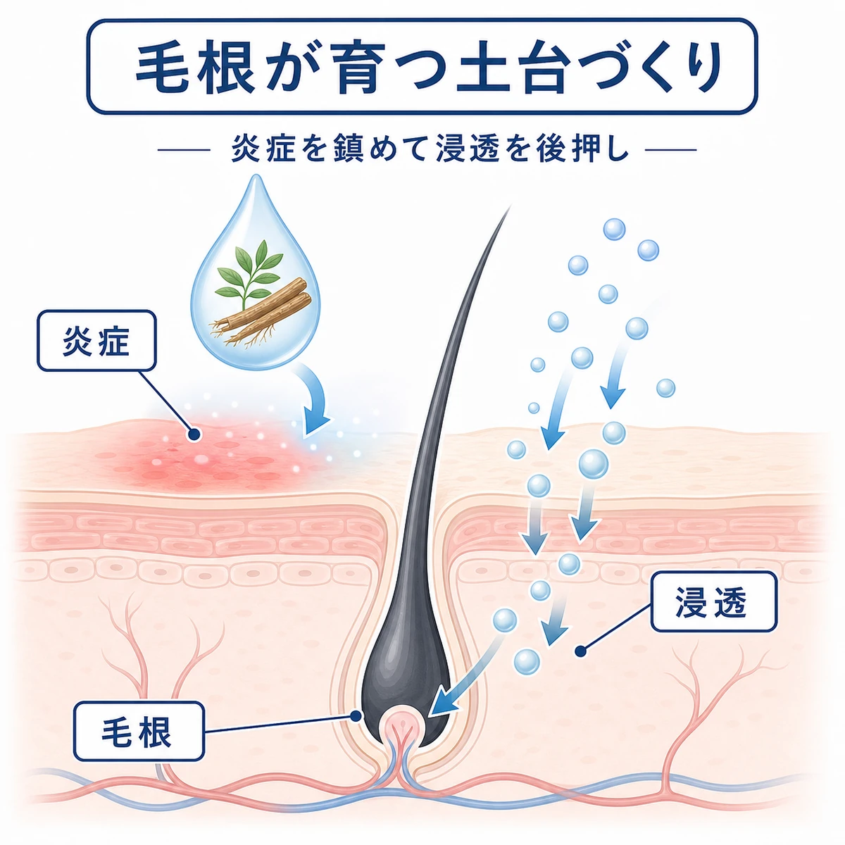 頭皮の炎症を鎮めて毛根の土台を整える働きを断面図で表した医療イラスト