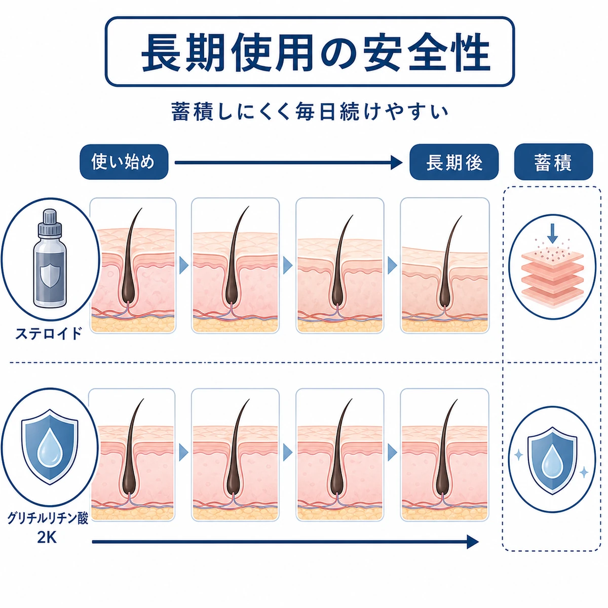 ステロイドとグリチルリチン酸2Kの長期使用による頭皮への影響の違いをタイムラインで表した医療イラスト