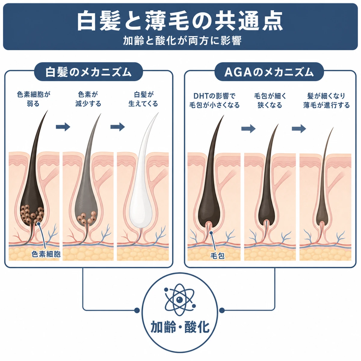白髪とAGAそれぞれの仕組みと共通する加齢の影響を表した医療イラスト