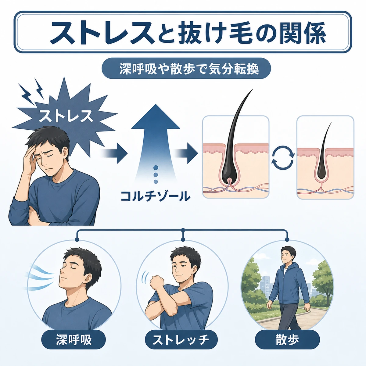 ストレスが抜け毛につながる仕組みと対策を表した医療イラスト