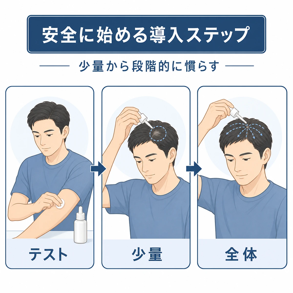 パッチテストから少量塗布、全体使用へと段階的に進める育毛剤の導入手順を表した医療イラスト