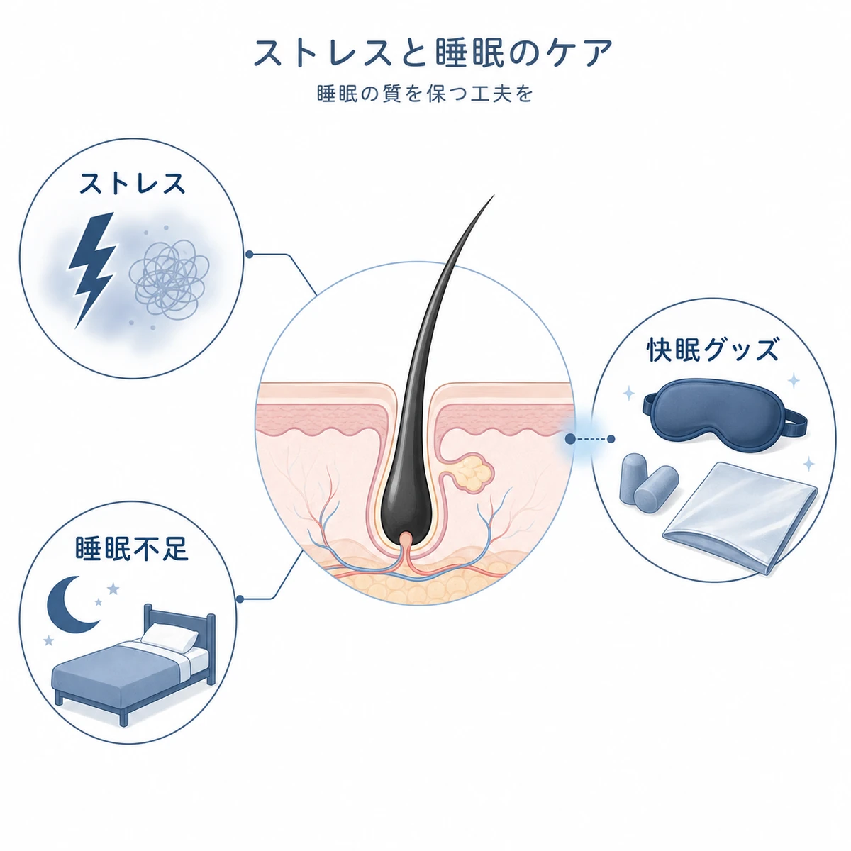ストレスや睡眠不足が毛根に与える影響と快眠グッズによる対策の関係を表した医療イラスト
