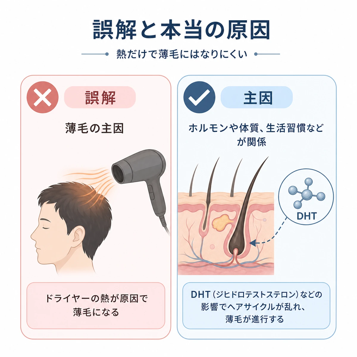 ドライヤーの熱と薄毛の誤解、そしてDHTという本当の原因を対比した医療イラスト