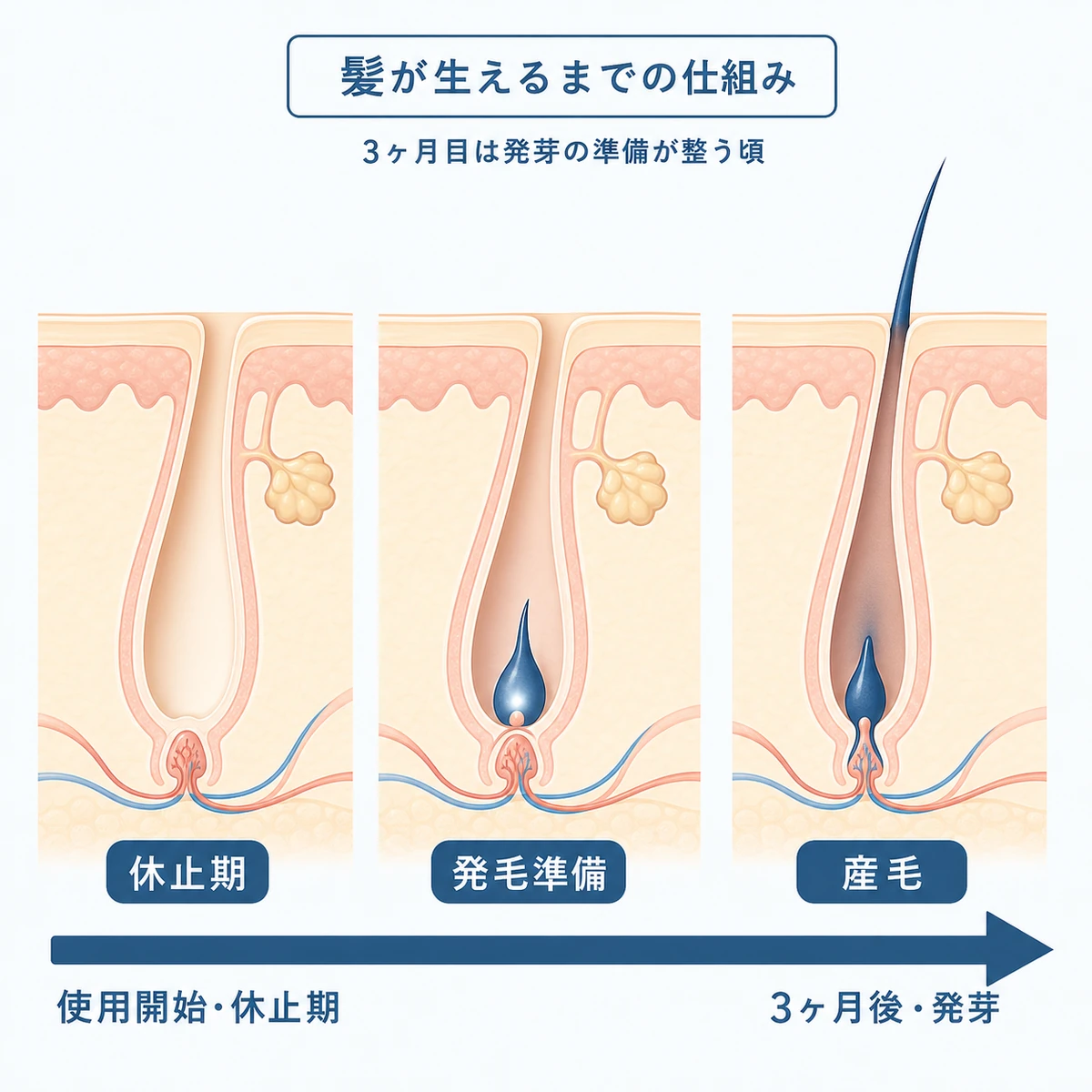 休止期の毛穴から産毛が生えるまでのヘアサイクルの流れを表した医療イラスト