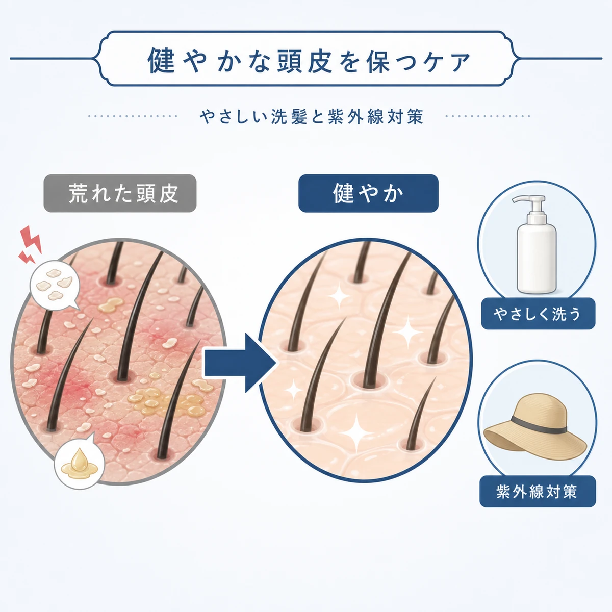 荒れた頭皮から健やかな頭皮へ整えるケアの違いを表した医療イラスト