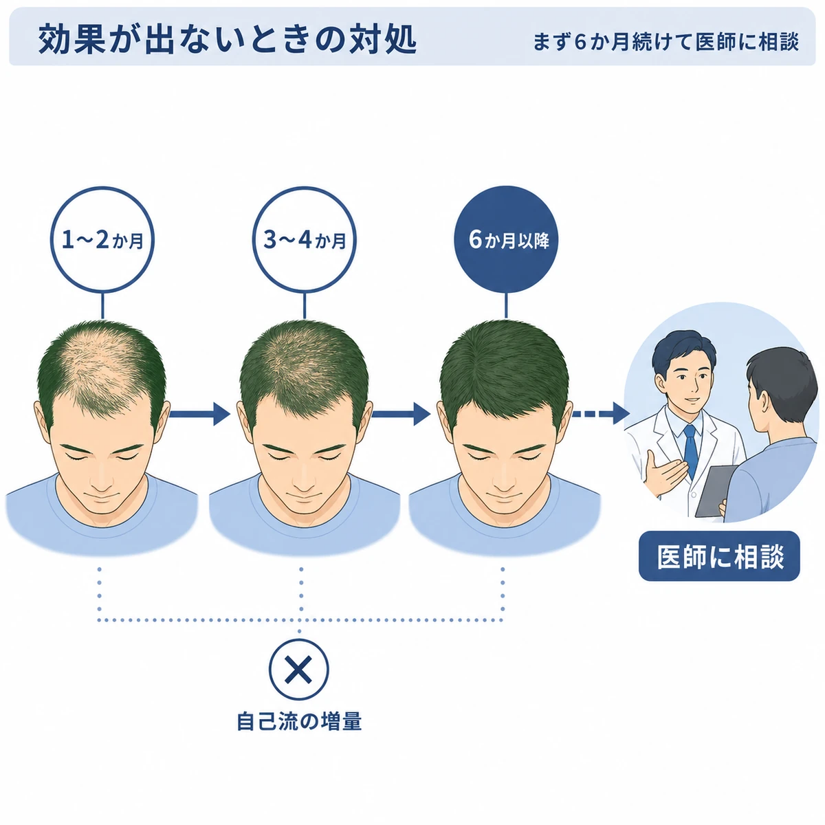 育毛剤は6か月続けて効果を判断し医師に相談するまでの流れを表した医療イラスト