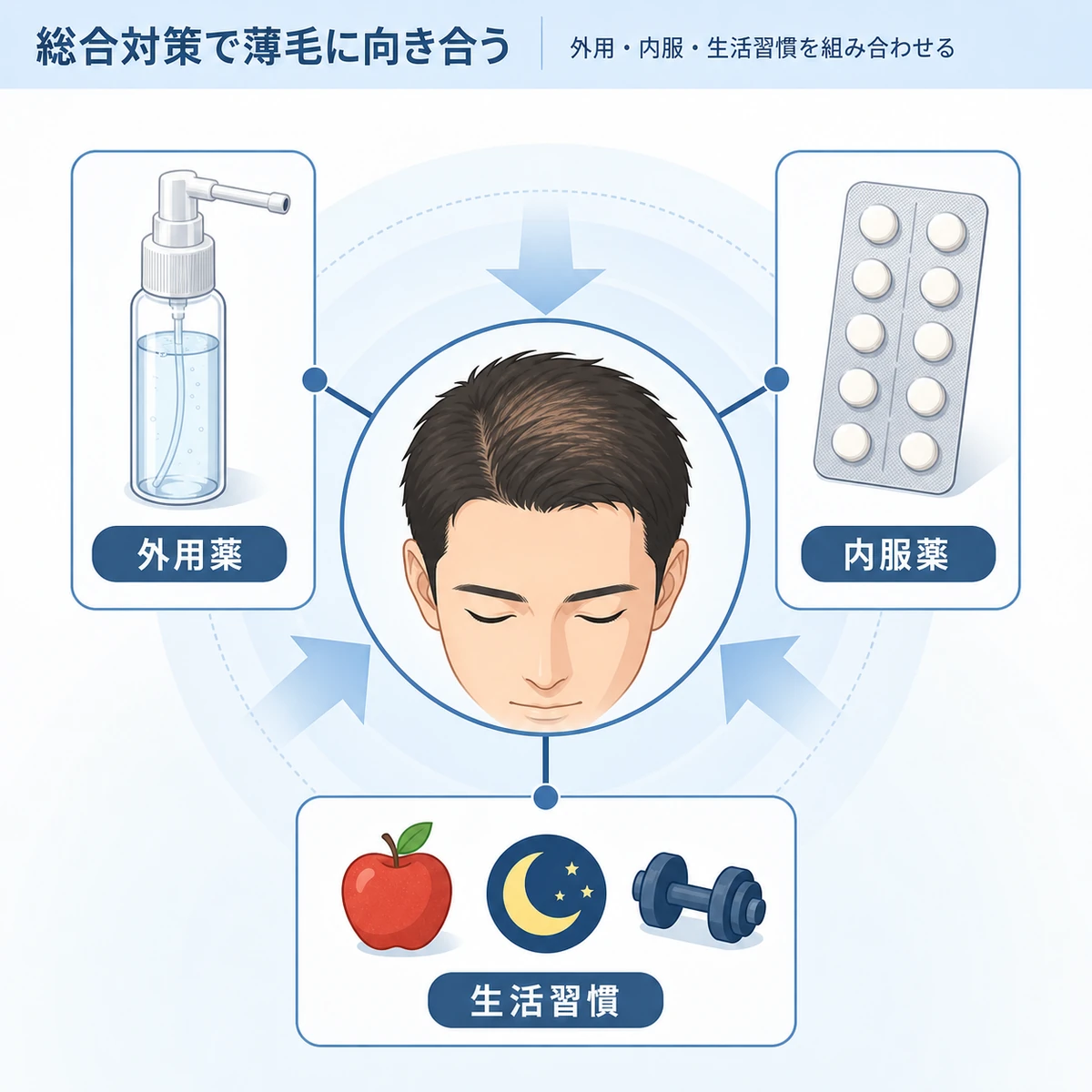 外用薬と内服薬と生活習慣を組み合わせたAGAの総合的な薄毛対策を表した医療イラスト