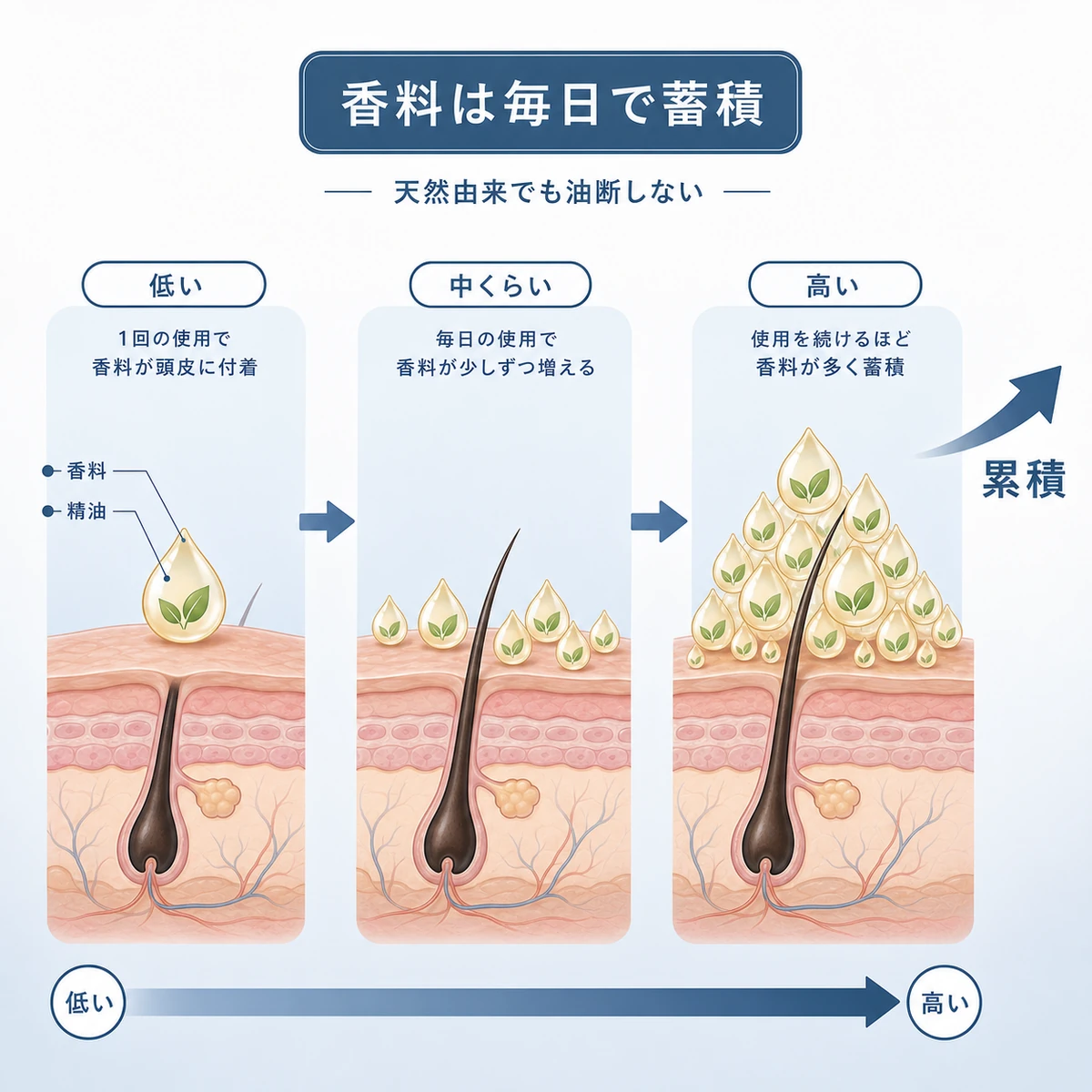 毎日の使用で香料成分が頭皮に少しずつ蓄積していく流れを表した医療イラスト