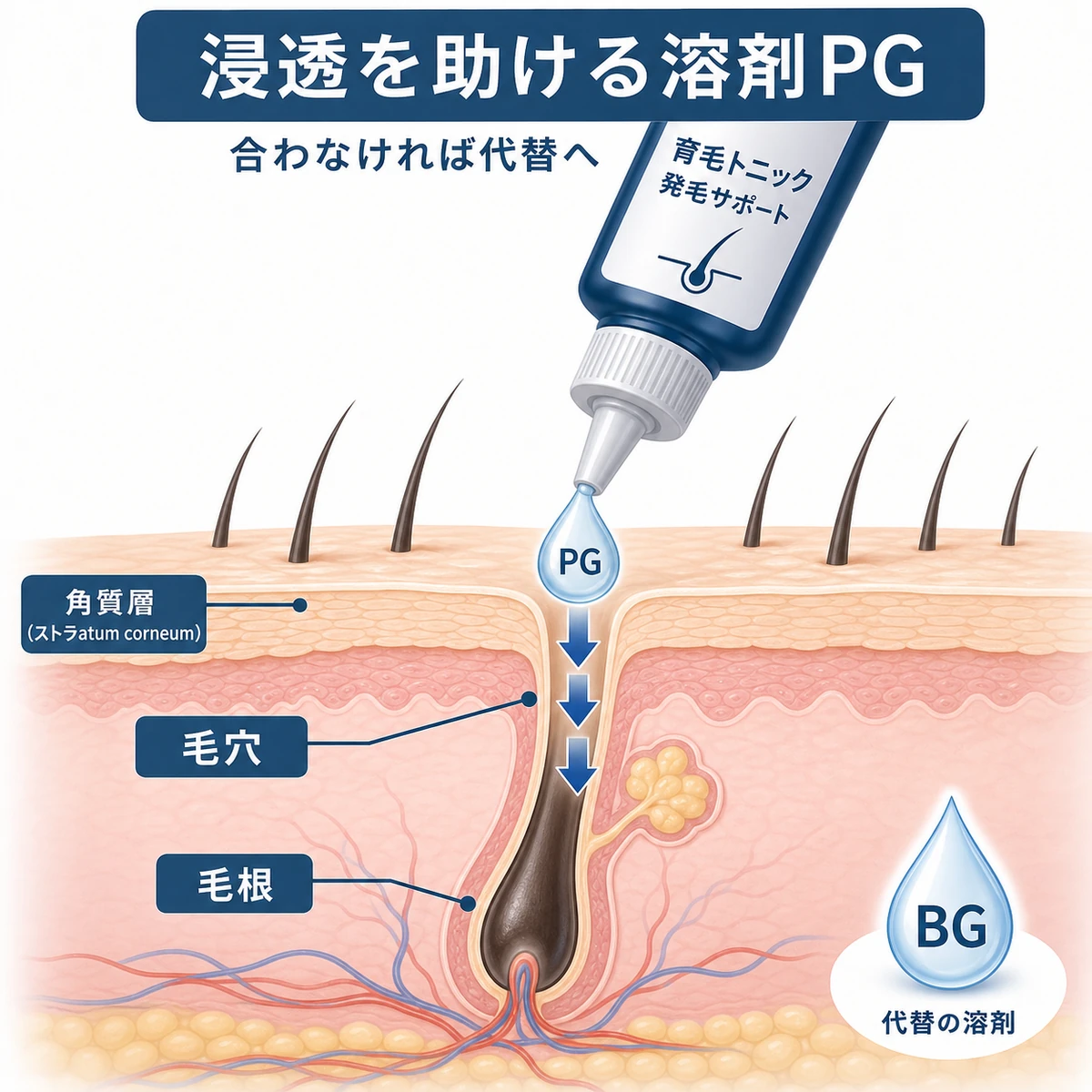 溶剤プロピレングリコールが頭皮の毛穴へ下向きに浸透していくしくみを表した医療イラスト
