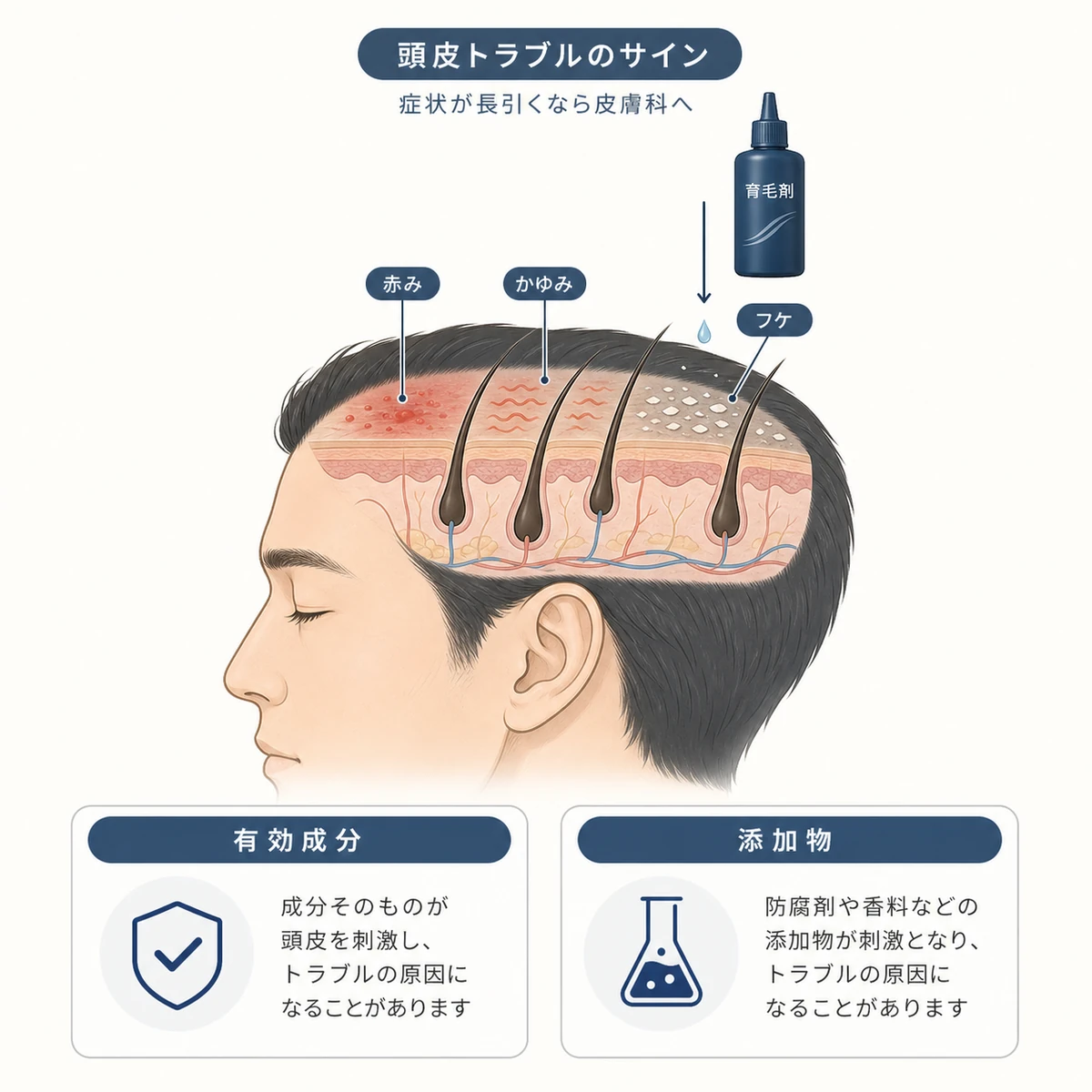 育毛剤による頭皮のかゆみや赤みがアレルギー反応のサインであることを表した医療イラスト