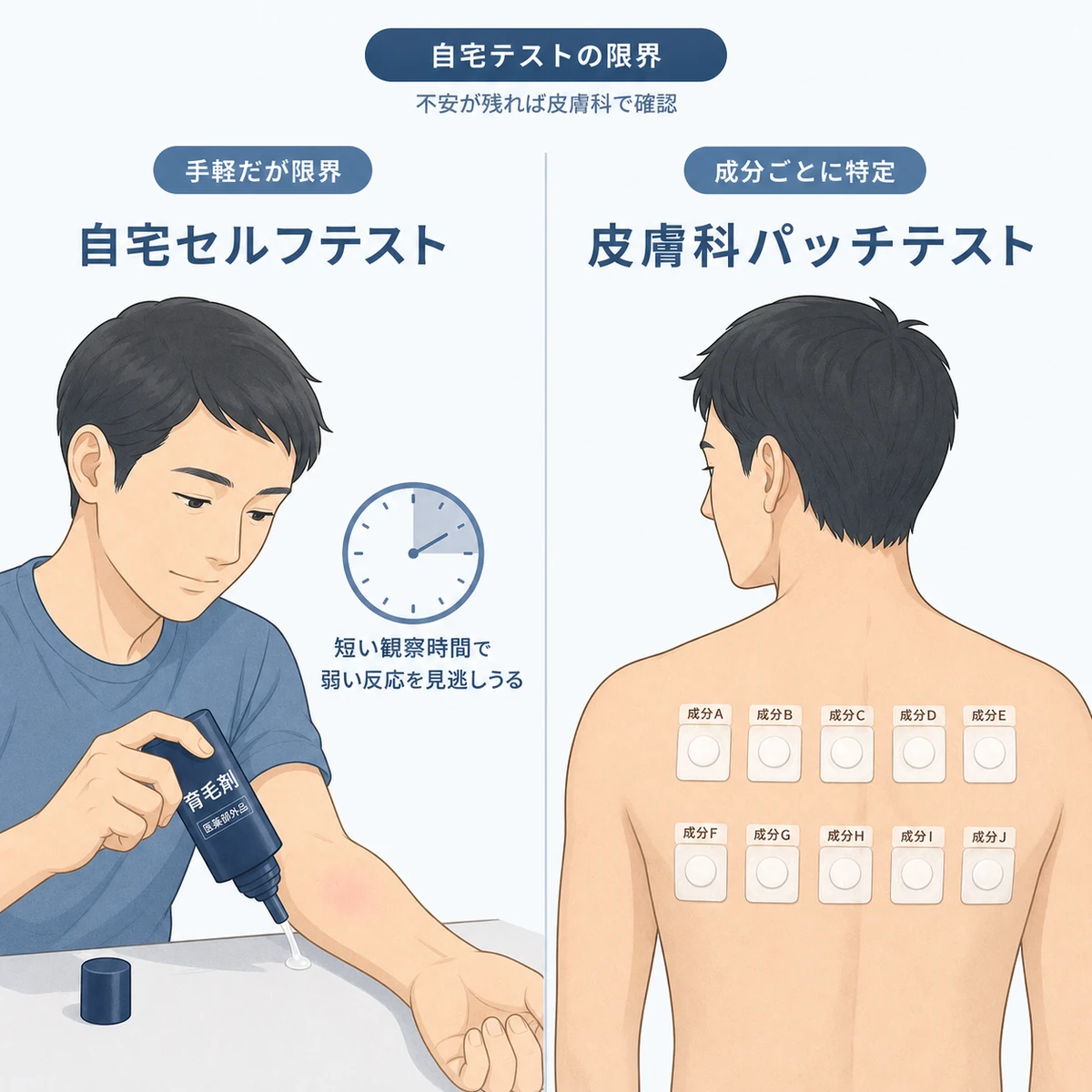 自宅セルフテストと皮膚科パッチテストの精度の違いを対比して表した医療イラスト