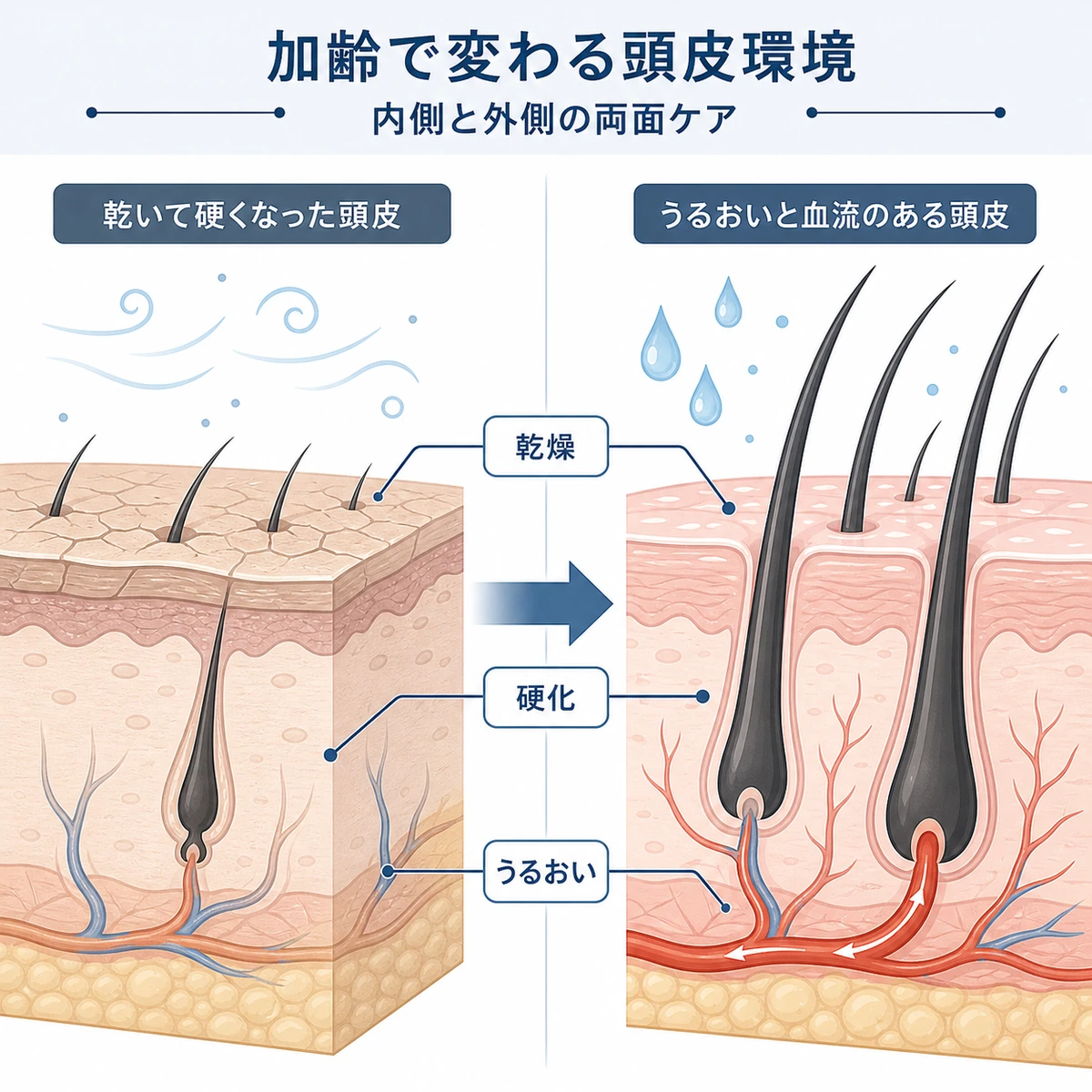 加齢で乾燥した頭皮と育毛剤でうるおった頭皮の断面を対比した医療イラスト