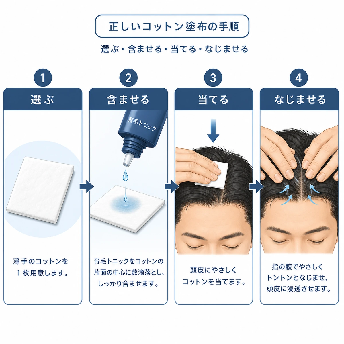 コットンで育毛剤を塗る正しい4ステップの手順を左から右へ並べた医療イラスト