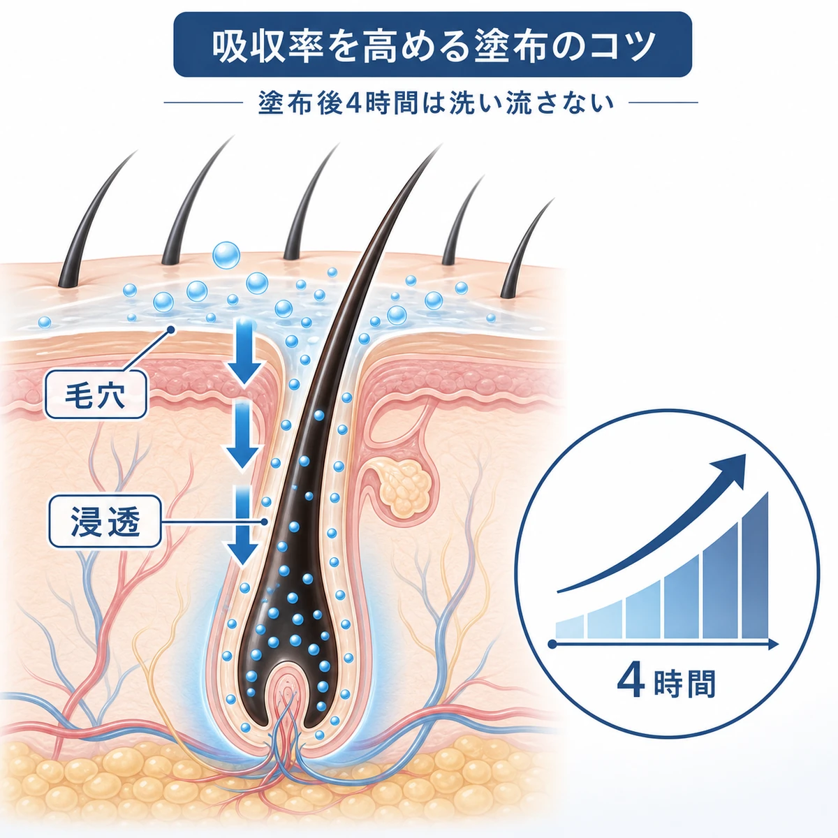 毛穴から毛根へ育毛成分が浸透し時間とともに吸収が高まる様子を示した医療イラスト