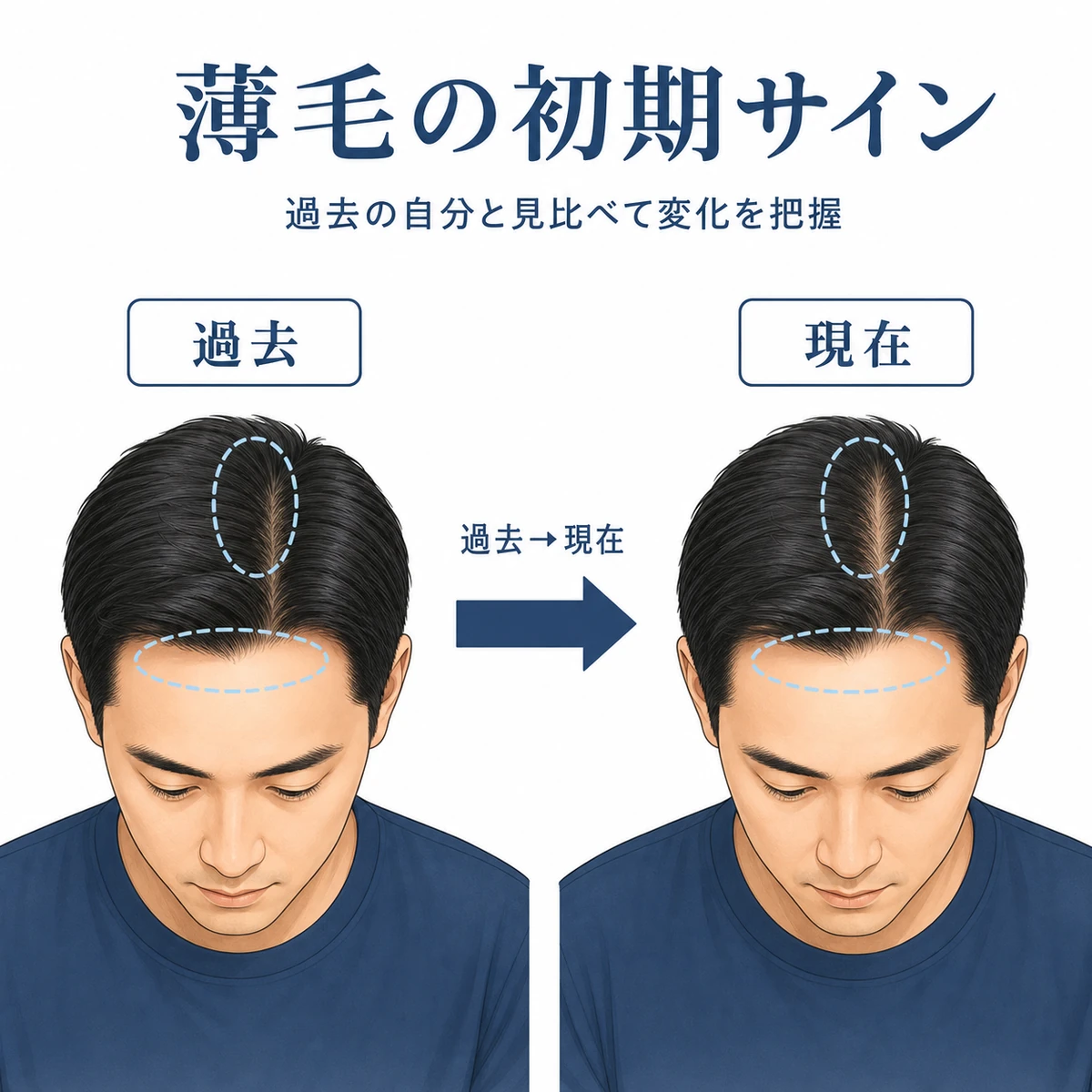 過去と現在の頭部を左右に並べて初期の変化に気づく流れを表した医療イラスト