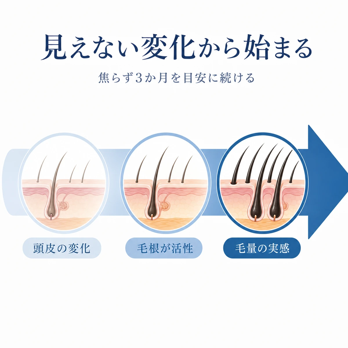 育毛剤の効果が内部の変化から表面の実感へと段階的に進む流れを表した医療イラスト