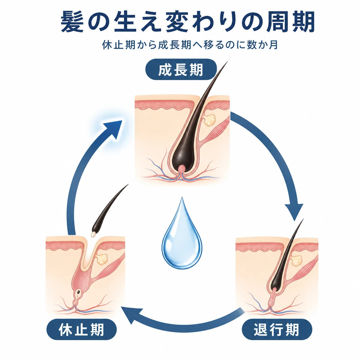 髪が成長期から退行期を経て休止期へと巡るヘアサイクルの仕組みを表した医療イラスト