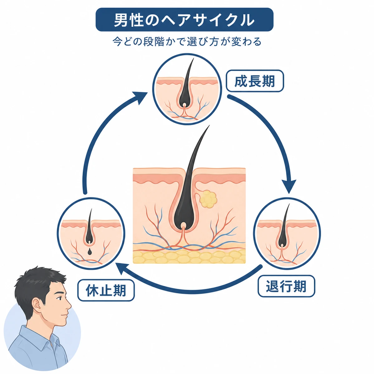 男性のヘアサイクルにおける成長期・退行期・休止期の循環を表した医療イラスト
