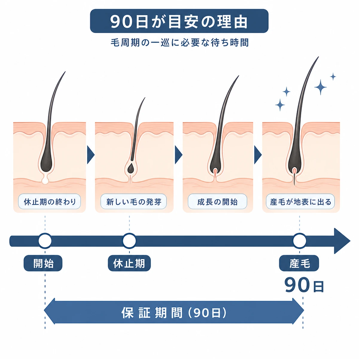 毛周期の一巡と90日間の保証期間が重なる待ち時間を表したタイムラインの医療イラスト