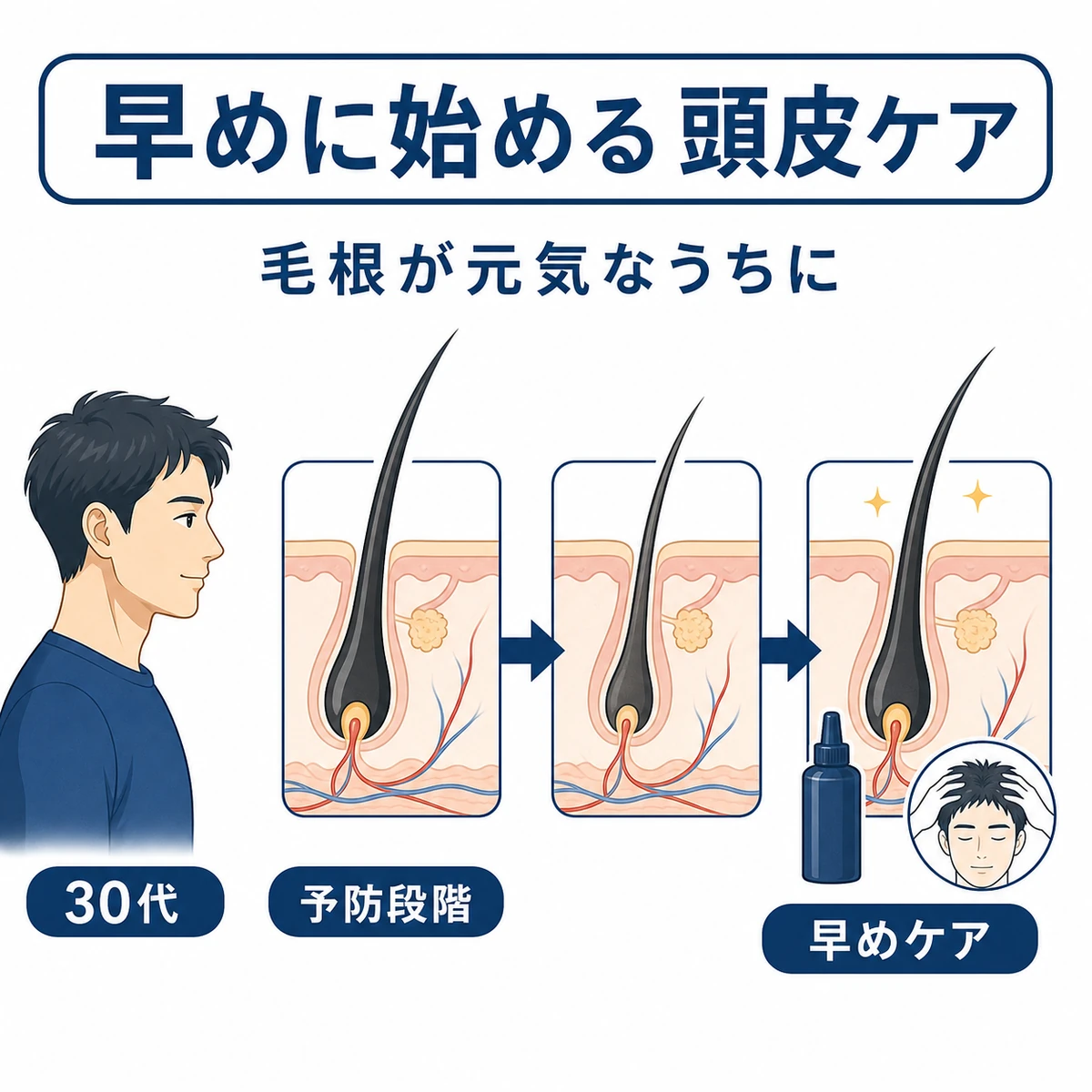30代男性の毛根が早めのケアで健やかに保たれる時系列を表した医療イラスト