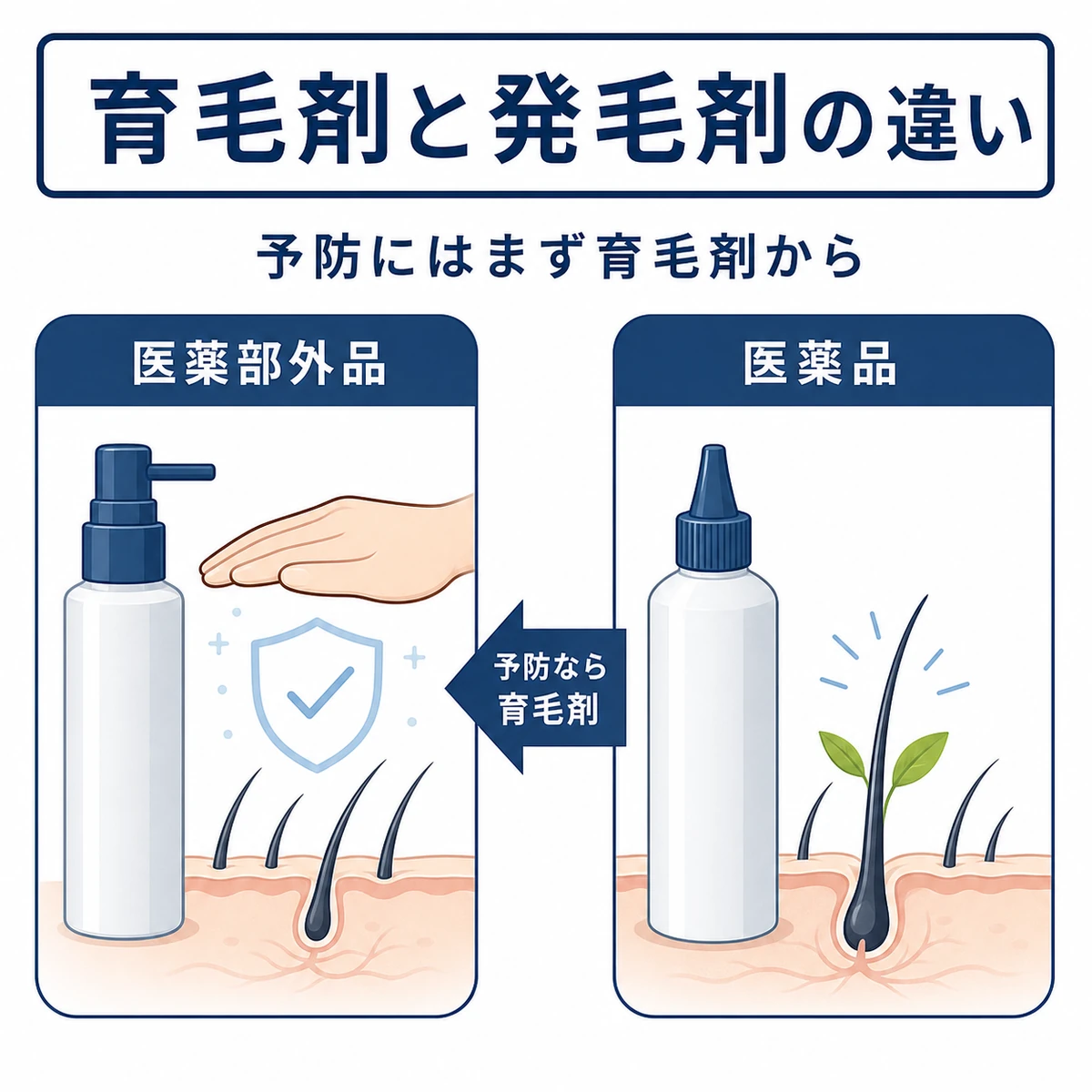 育毛剤と発毛剤の役割の違いを左右で対比した医療イラスト