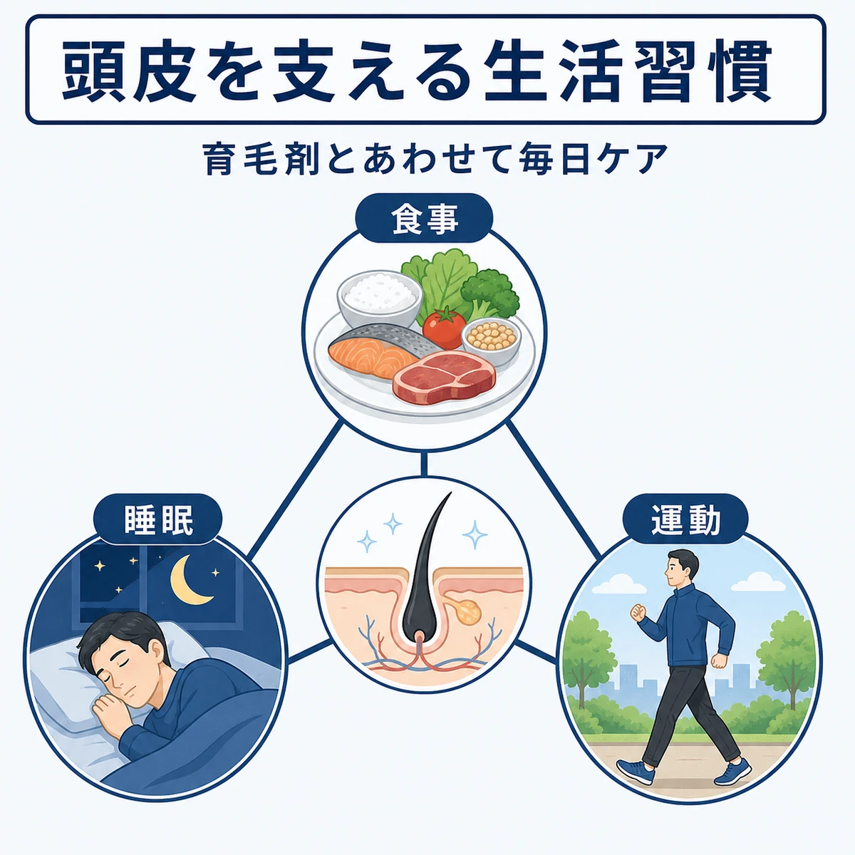 食事と睡眠と運動が頭皮を支えるバランスを三角形で表した医療イラスト