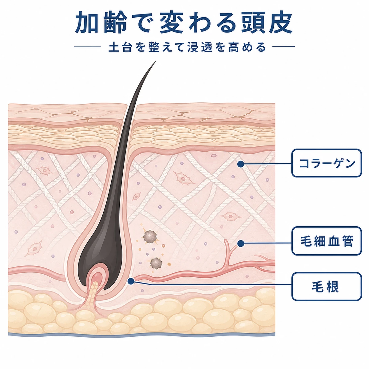 加齢による頭皮の断面変化と成分の相性を層状に表した医療イラスト