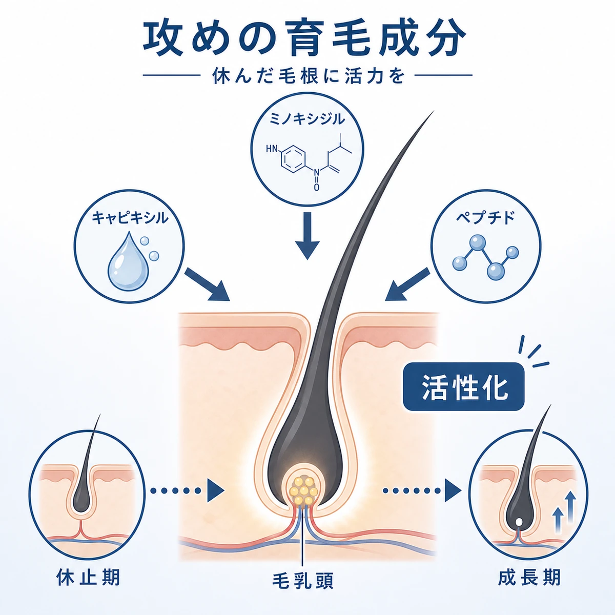 毛乳頭細胞に働きかけ毛根を成長期へ導く攻めの育毛成分の仕組みを示した医療イラスト