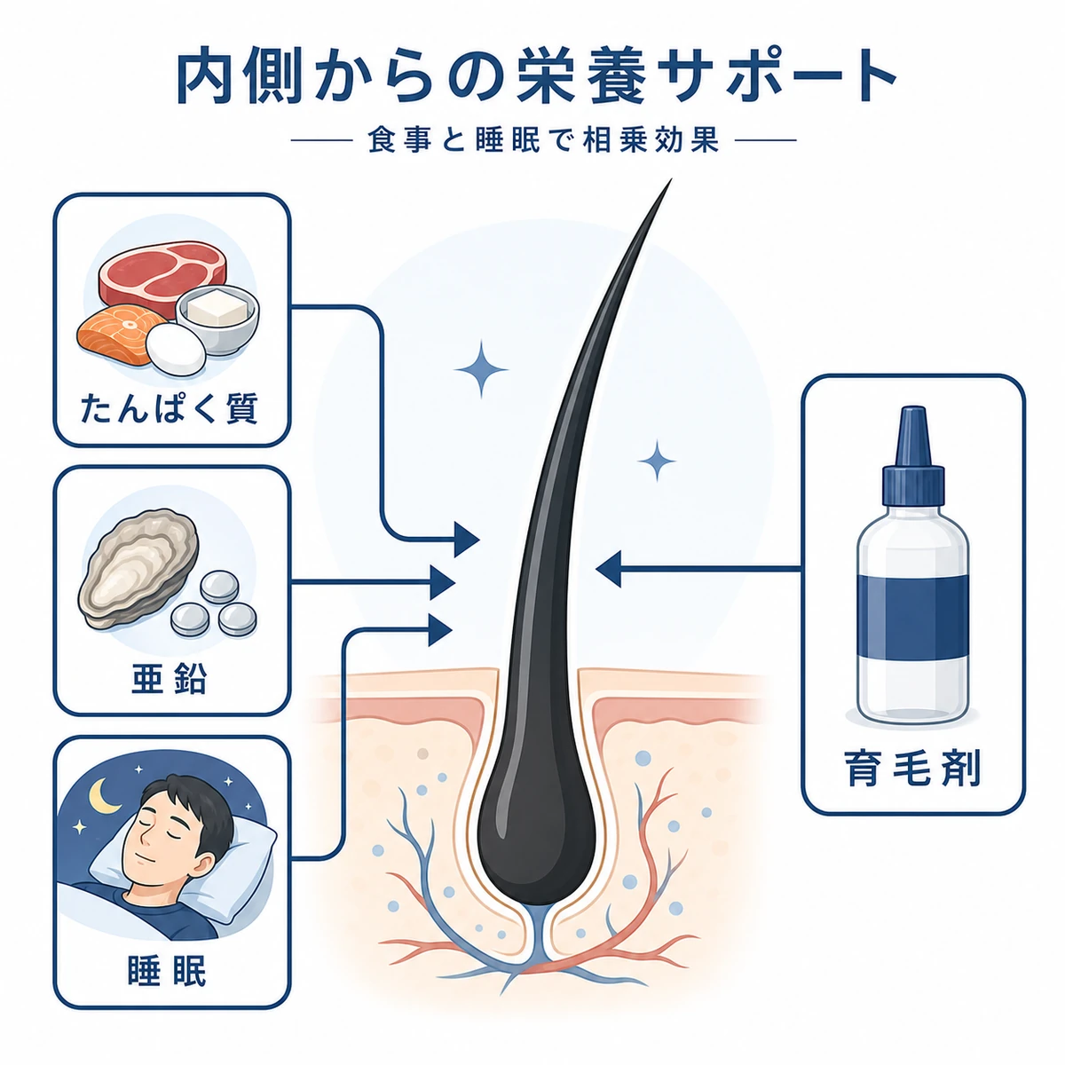 食事と睡眠による内側の栄養が育毛剤と合わさり相乗する様子を表した医療イラスト
