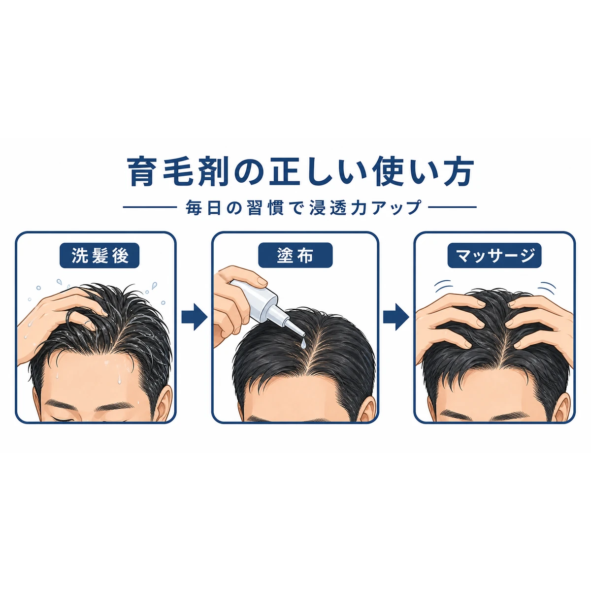 育毛剤の効果を高める正しい使い方の手順を段階的に表した医療イラスト